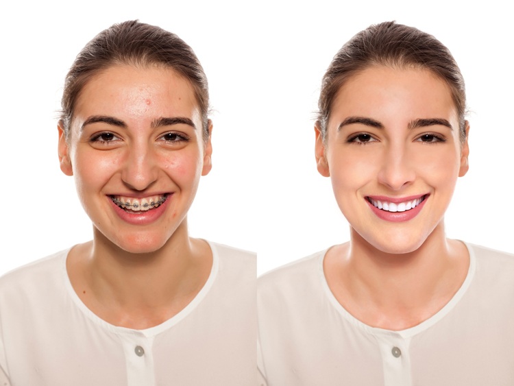 Photo Retouching Services and Image Restoration service Photo Retouching Services and Image Restoration service